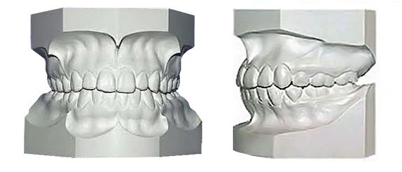 Study Models Full